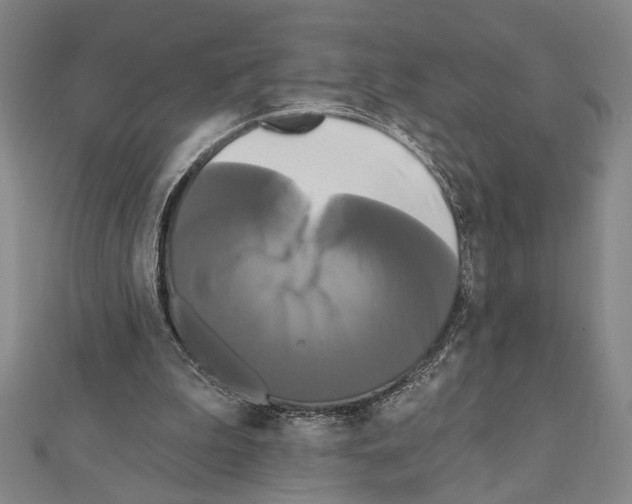 X0000111460199200908241326