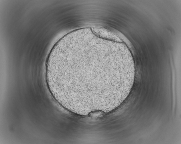X0000111461096200908241314