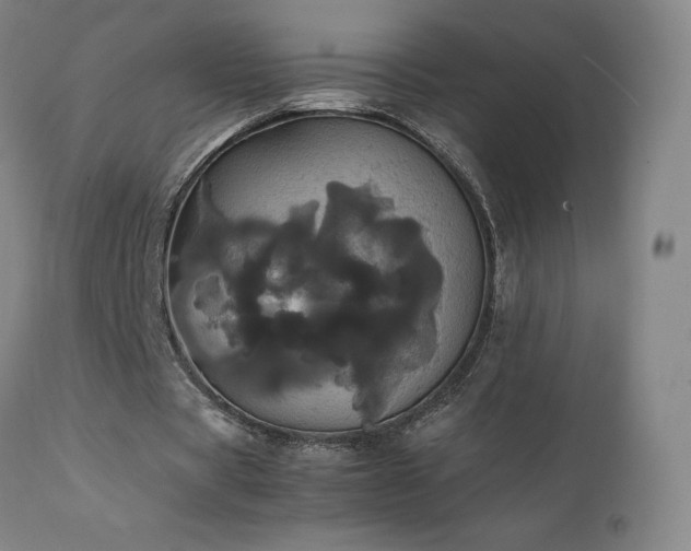 X0000111470529200907131520