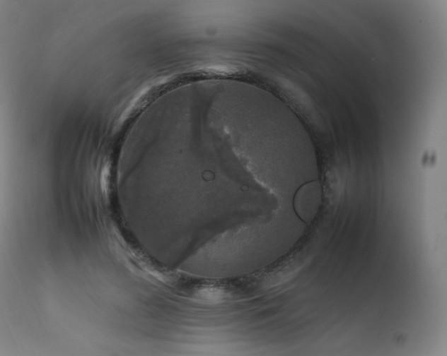 X0000111470596200907131520