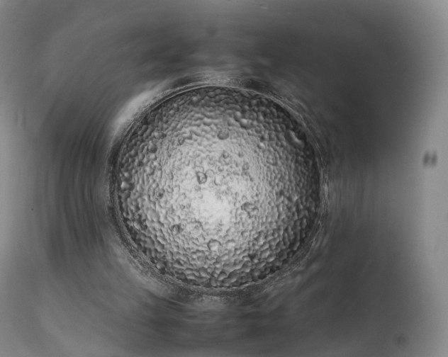 X0000111470149200907201145