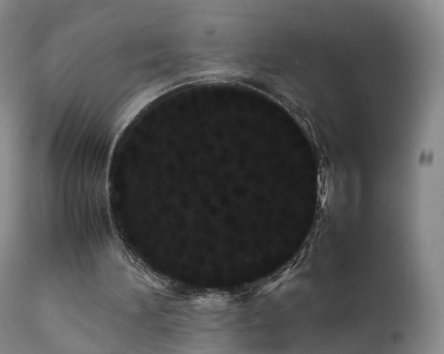 X0000111470196200907201145