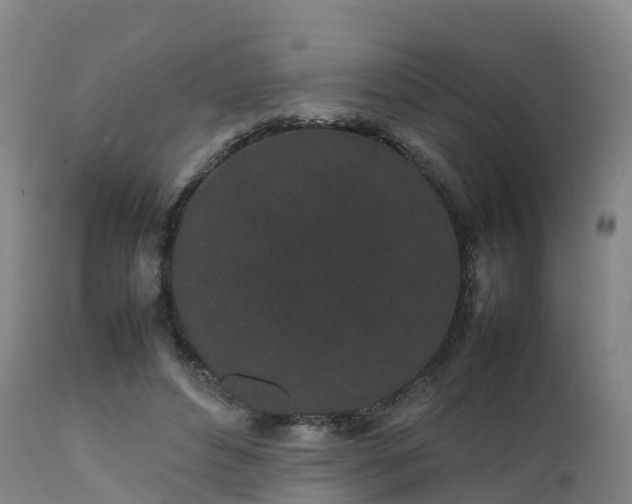 X0000111470496200907201140