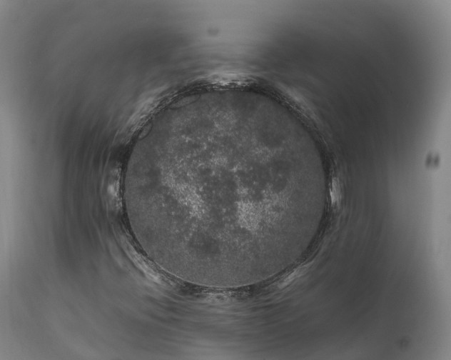 X0000111471396200907201125