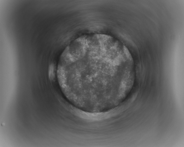 X0000111470038200908031409