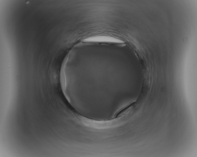 X0000111470039200908031409