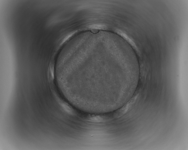 X0000111470062200908031409