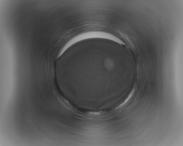 X0000111470170200908031407