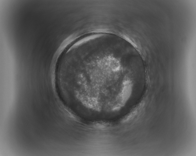 X0000111470199200908031407