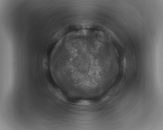 X0000111470218200908031407