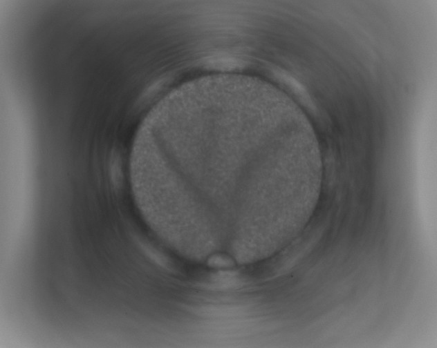 X0000111470114200908101122