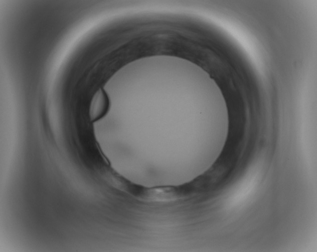 X0000111470239200908101121