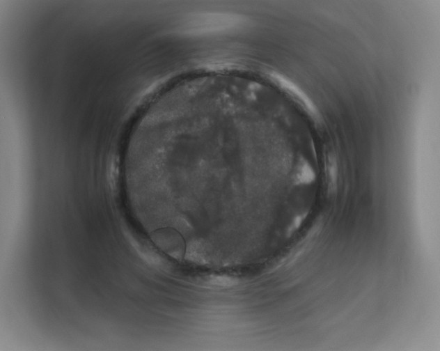 X0000111470592200908101116