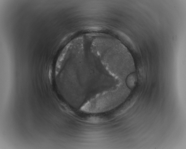 X0000111470596200908101116