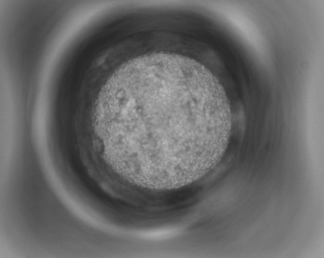 X0000111470765200908101114