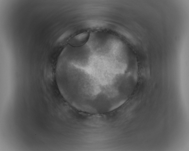 X0000111470869200908101113