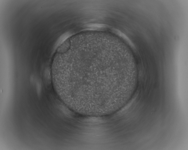 X0000111471362200908101106