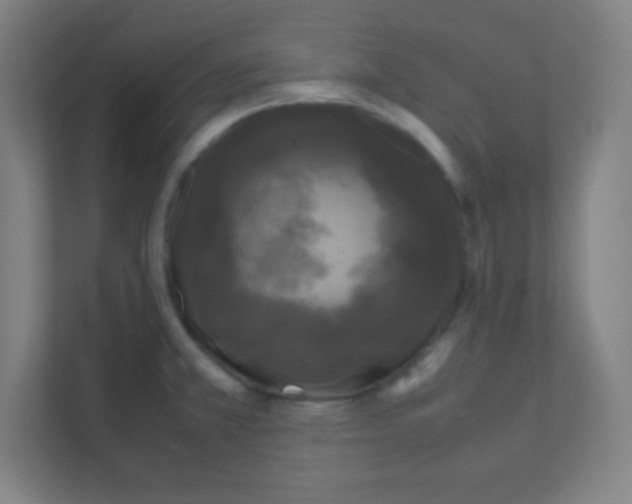 X0000111471381200908101106