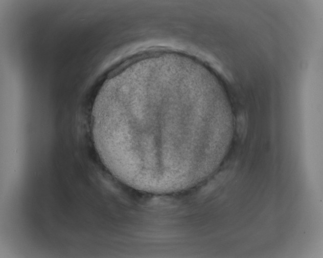 X0000111471496200908101104