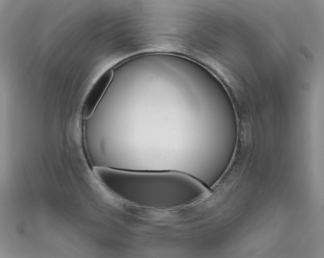 X0000111481468200907141033