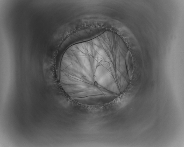 X0000111480192200907210956