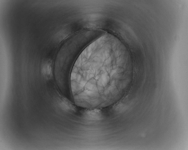 X0000111480576200907210951