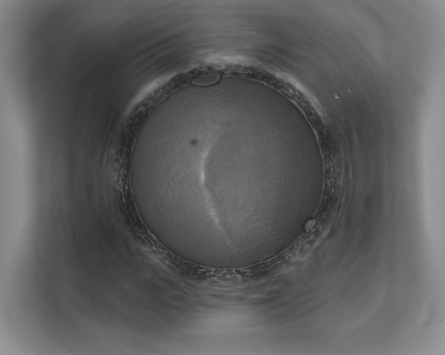 X0000111480919200907210945