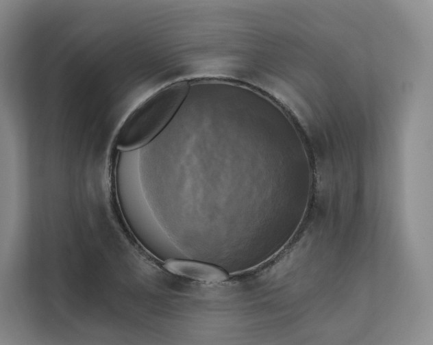 X0000111481077200907210944