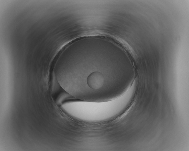 X0000111481457200907210939