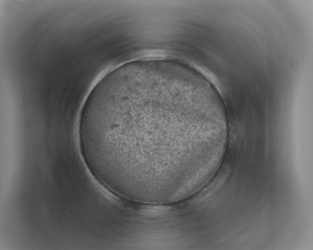 X0000111481475200907210938