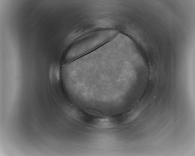 X0000111480068200908041130
