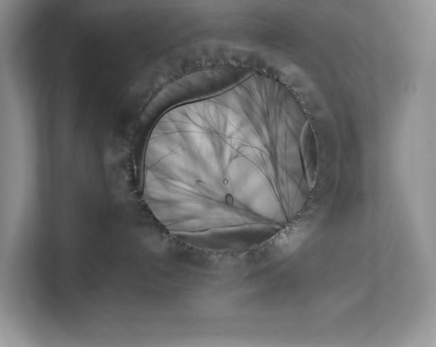X0000111480192200908041129