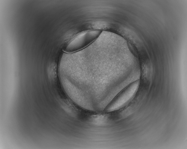 X0000111480356200908041127