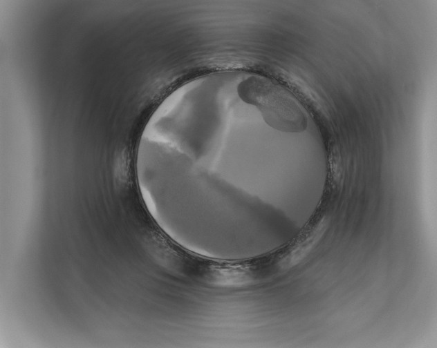 X0000111480359200908041127