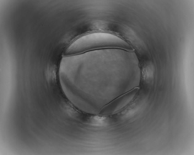 X0000111480570200908041124