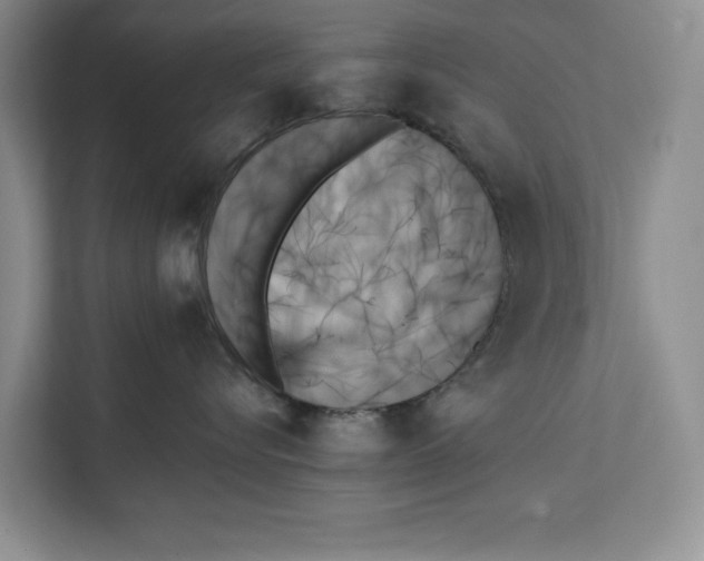 X0000111480576200908041124