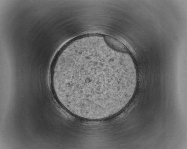 X0000111481076200908041117