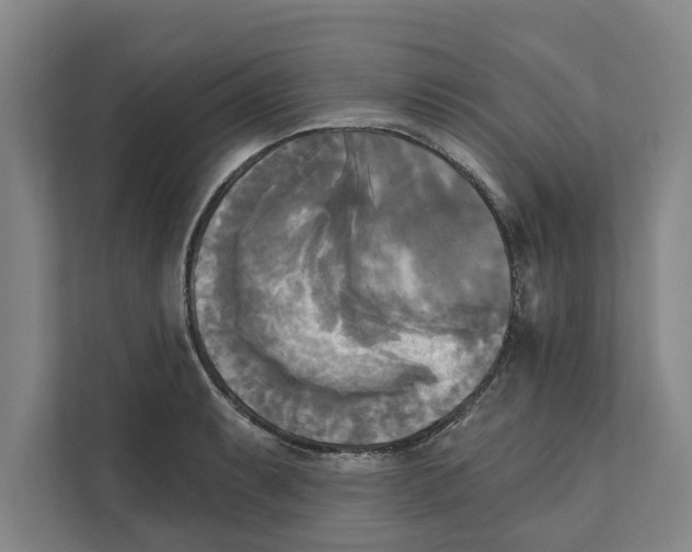 X0000111481087200908041117