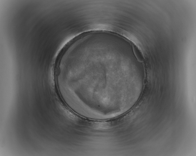 X0000111481120200908041116