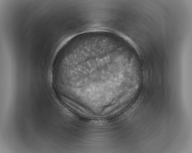 X0000111481415200908041113