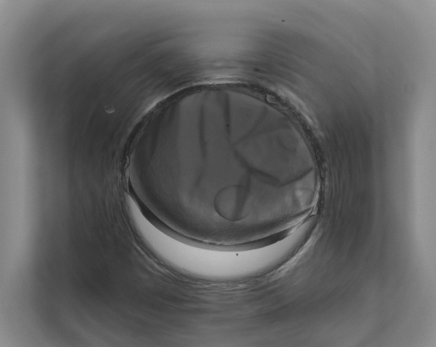 X0000111481449200908041112
