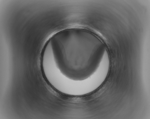 X0000111481463200908041112