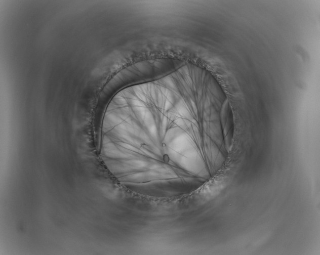 X0000111480192200908111210