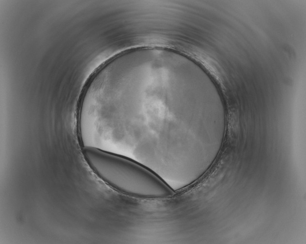 X0000111480944200908111158