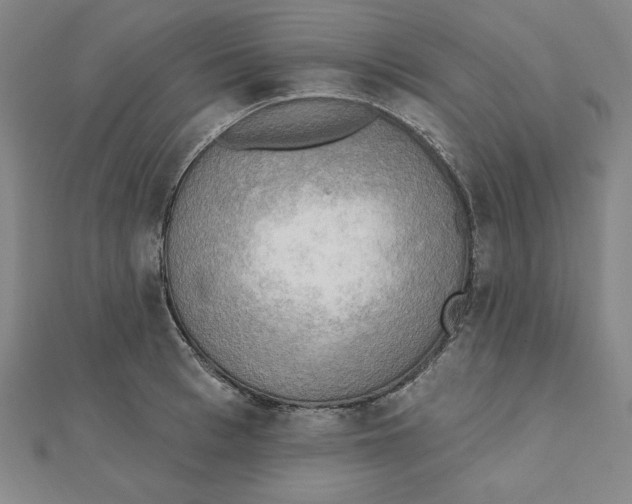 X0000111480993200908111157