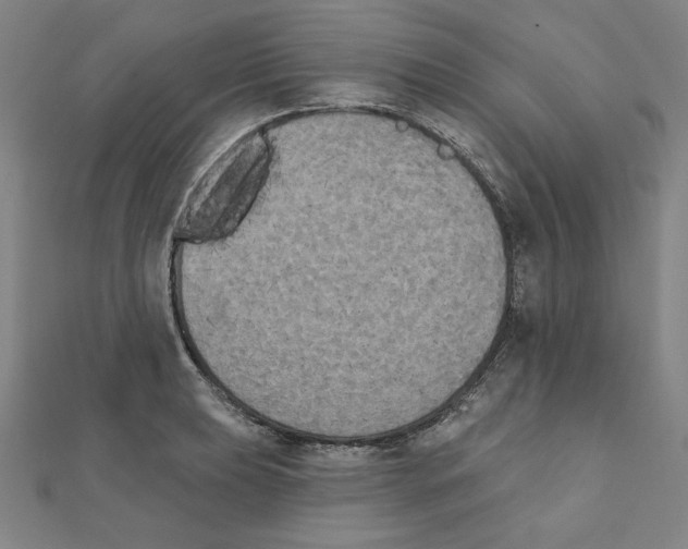 X0000111481039200908111156