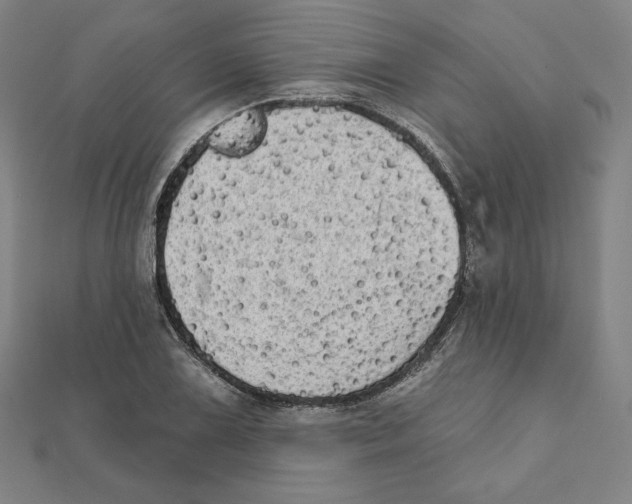 X0000111481075200908111156