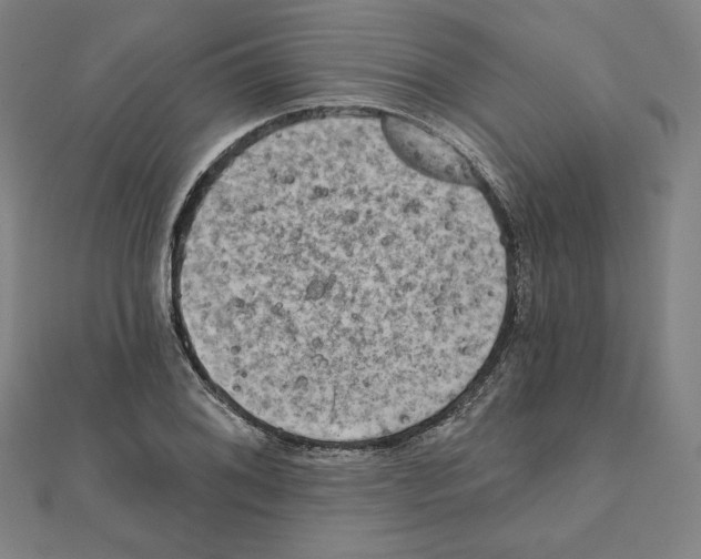 X0000111481076200908111156