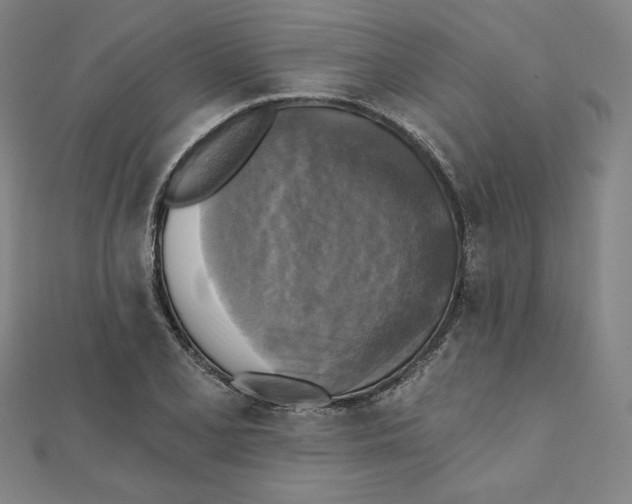 X0000111481077200908111156
