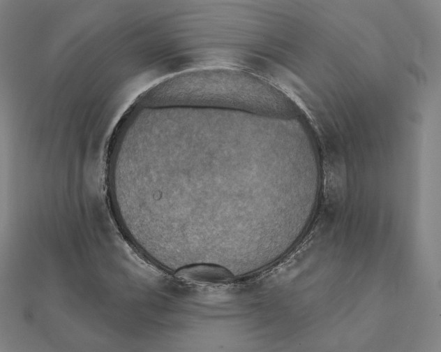 X0000111481116200908111155